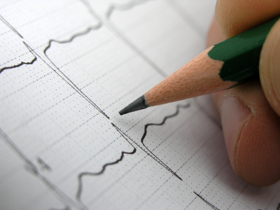 Electrocardiography - Manhattan Cardiology